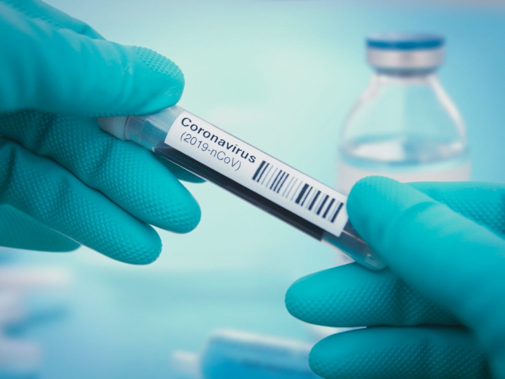با جداسازی کروناویروس، دانشمندان کانادایی به تولید واکسن کووید19 نزدیک شدند