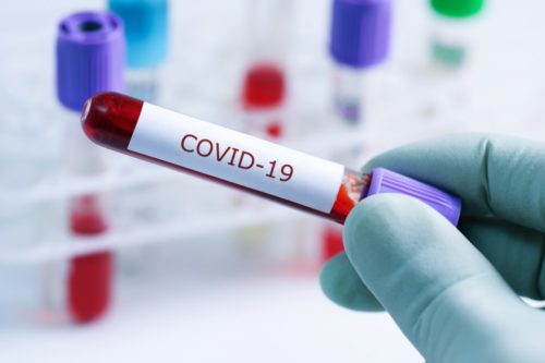 انتاریو : بیش از ۲۰۰ نفر مبتلای جدید ویروس کرونا در هفته 