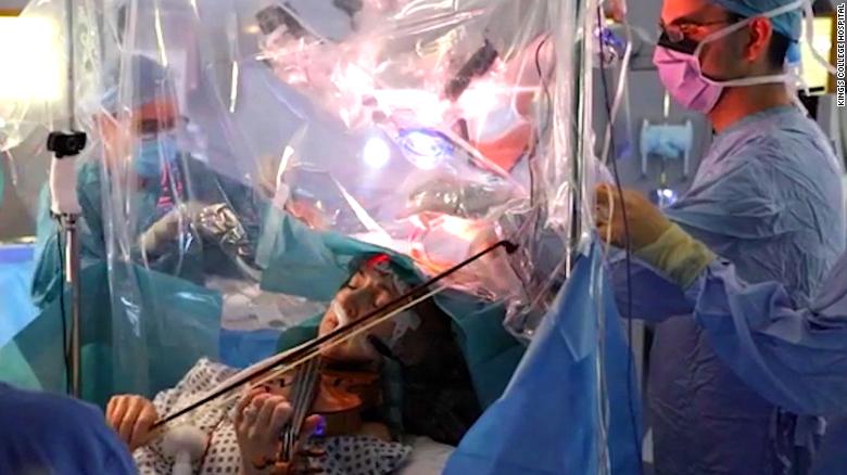 Dagmar Turner, a violinist for the Isle of Wight Symphony Orchestra, plays violin during surgery to remove a tumour from her brain, January 31, 2020. (King's College Hospital)