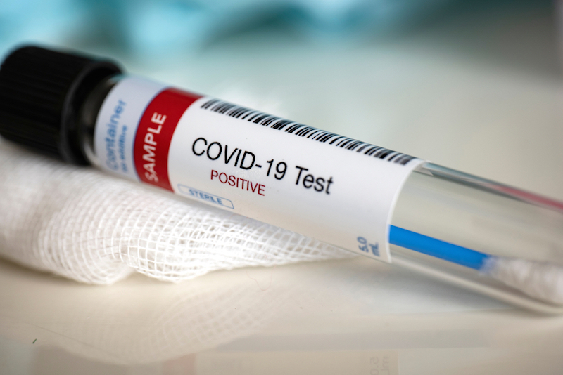 ویروس کرونا در انتاریو : ۱۸۹ نفر مبتلای جدید به کووید۱۹ و ۱۰ نفر فوت شده دیگر