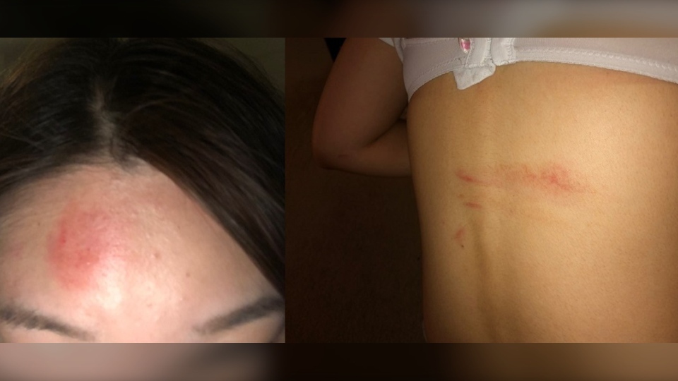 پلیس ونکوور از تحقیق در رابطه با ضرب و شتم یک دانشجوی دختر آسیایی خبر داد