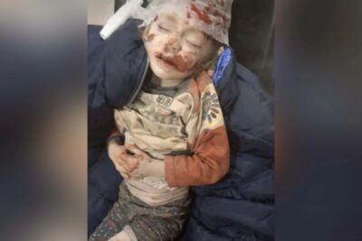 کودک مجروح از ساختمان بمب گذاری شده غیرنظامی در سومی اوکراین بیرون آورده شد