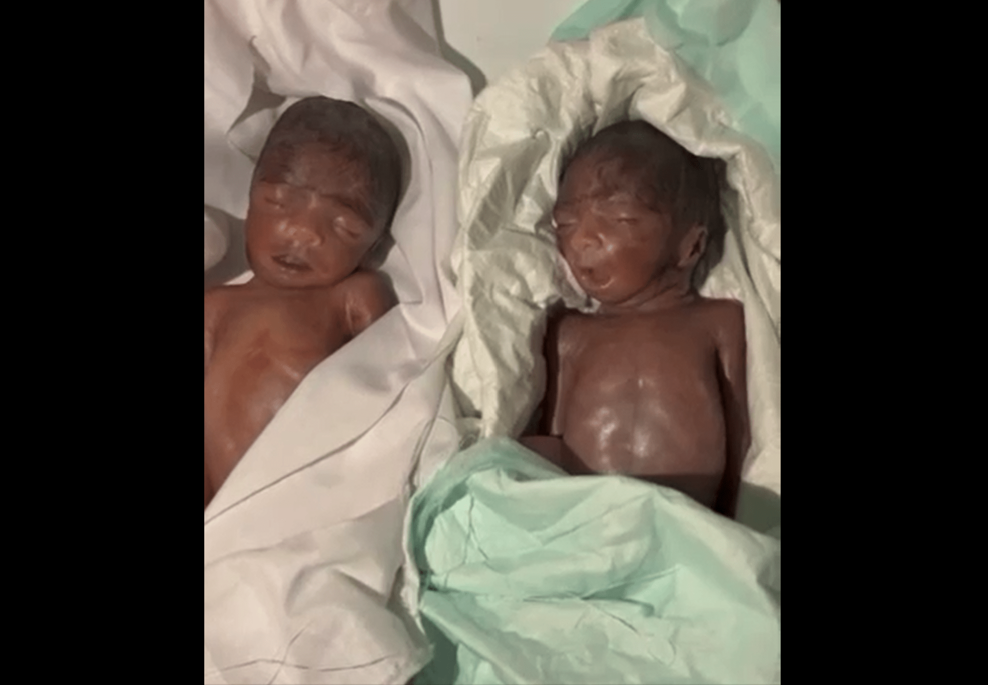 ‎مرگ دو نوزاد در بیمارستان امام علی چابهار و توضیحات رئیس شورای شهرستان زرآباد